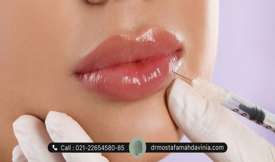 مراقبت‌های بعد از تزریق ژل لب
