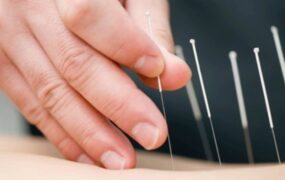 تاثیر طب سوزنی بر استرس