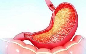مواد غذایی‌ کاهش التهاب معده