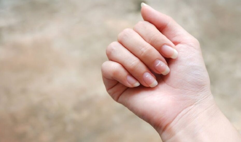 لکه‌های سفیدرنگ روی ناخن
