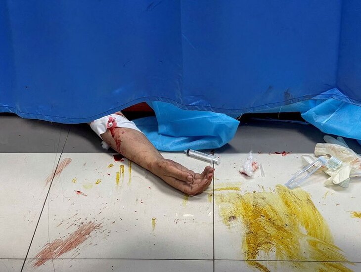 دیدنی های امروز؛ شرایط زندگی مردم مقاوم غزه 10 روز پس از بمباران اسراییل کمبود تخت برای بستری و مداوای زخمی ها