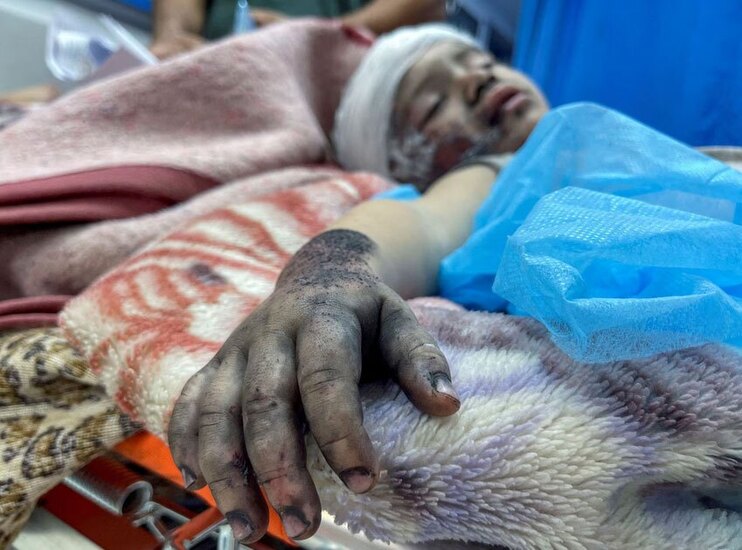 دیدنی های امروز؛ شرایط زندگی مردم مقاوم غزه 10 روز پس از بمباران اسراییل بیمارستان شفا در نوار غزه