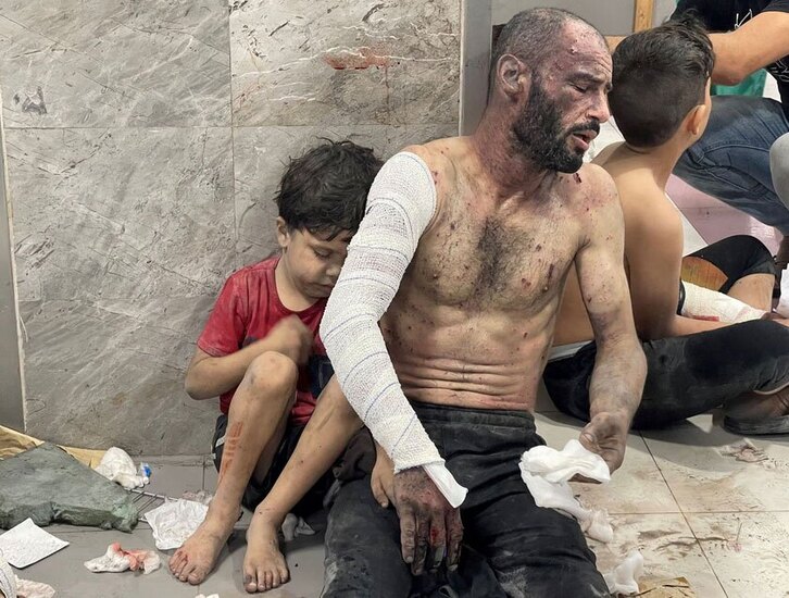 دیدنی های امروز؛ فاجعه انسانی در غزه زخمی های بمباران های اسراییل