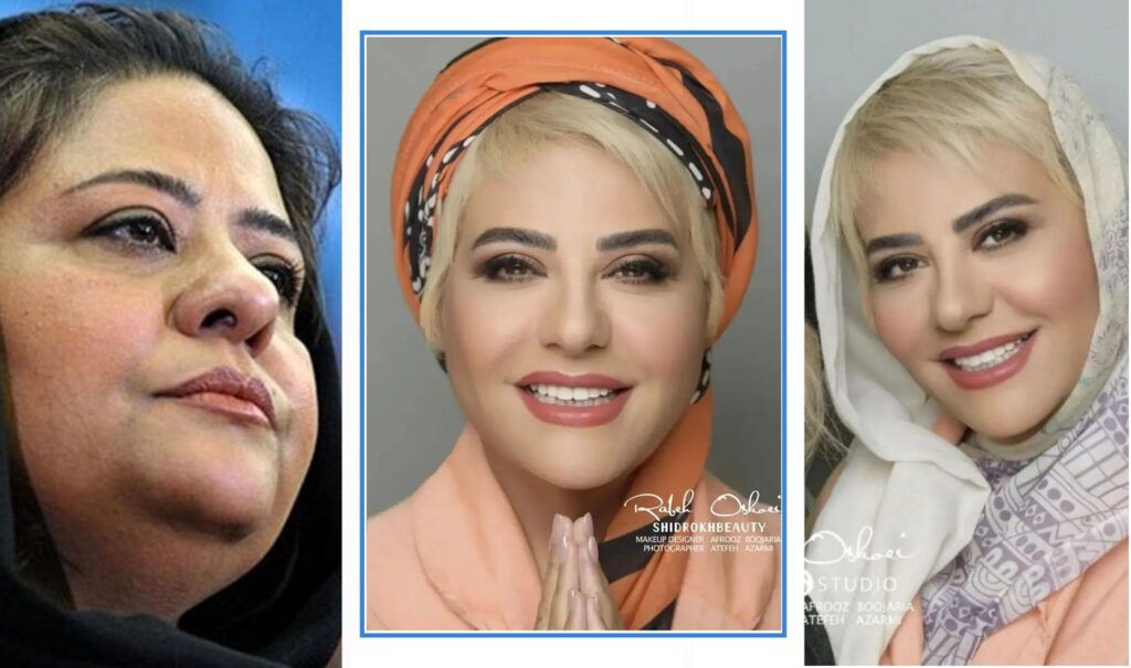 تغییر چهره رابعه اسکویی