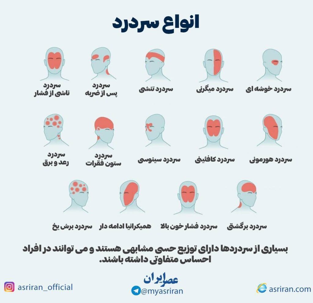 انواع سردرد