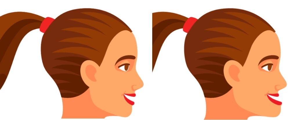 چند حرکت ساده برای رهایی از غبغب رهایی از غبغب