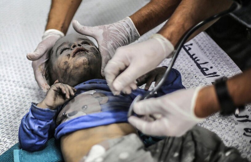 دیدنی های امروز؛ از ادامه حملات اسراییل به غزه تا سخنرانی سید حسن نصرالله معاینه یک کودک مجروح از حملات هوایی اسراییل