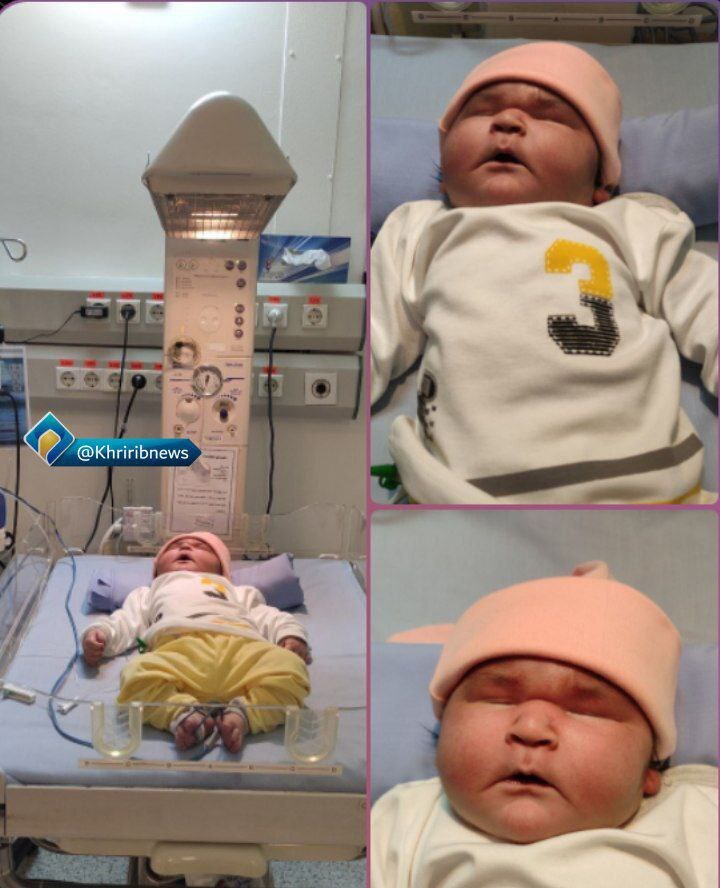 نوزاد 7 کیلویی