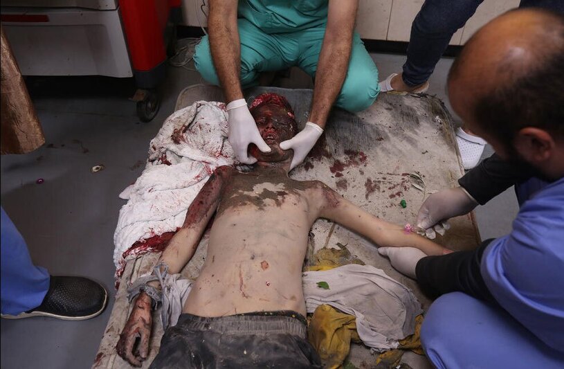 مصدومان حملات هوایی اسراییل در بیمارستان الاقصی