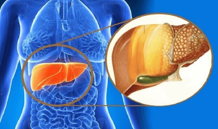 غذاهای مضر کبد چرب