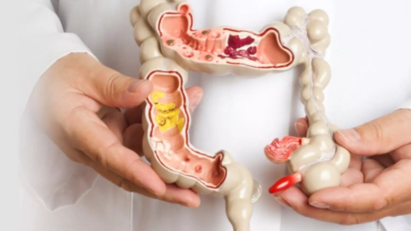 درد هر قسمت از شکم نشان دهنده چیست؟/ عکس درد شکم