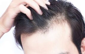 روش‌های مختلف جلوگیری از ریزش‌ مو