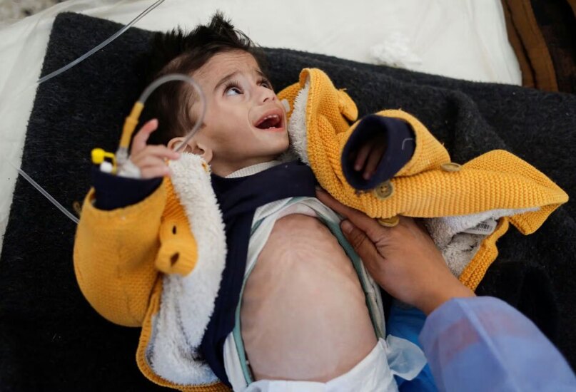 دیدنی های امروز؛ از جشن تولد پیرترین زن دنیا تا انتخابات مقدماتی آمریکا پدیدار شدن آثار سوء تغذیه خطرناک