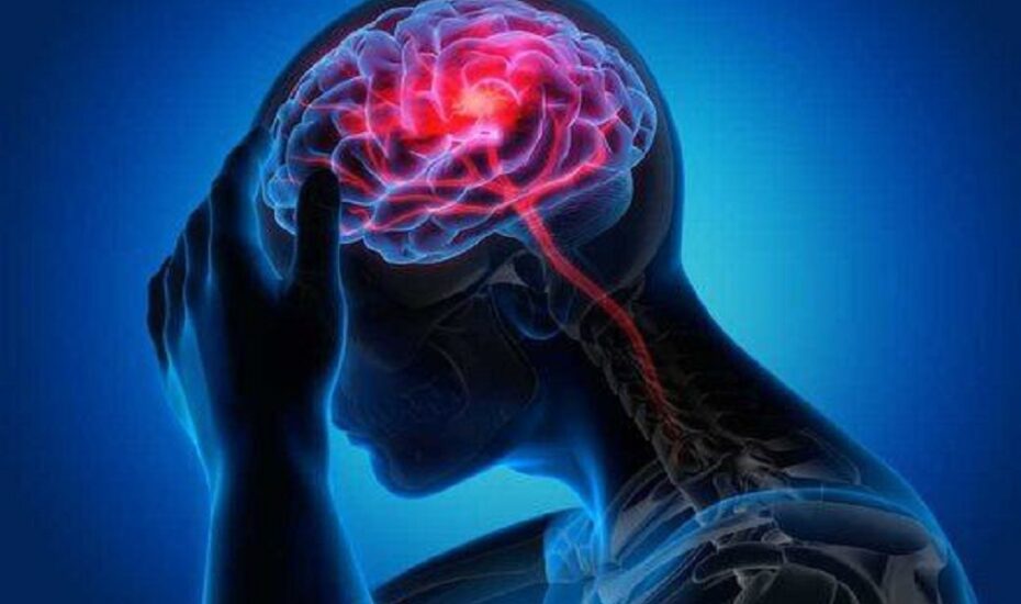 شایع‌ترین علامت سکته مغزی