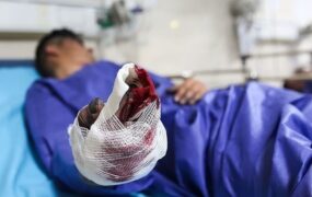قطع انگشتان پاکبان انفجار نارنجک چهارشنبه‌سوری