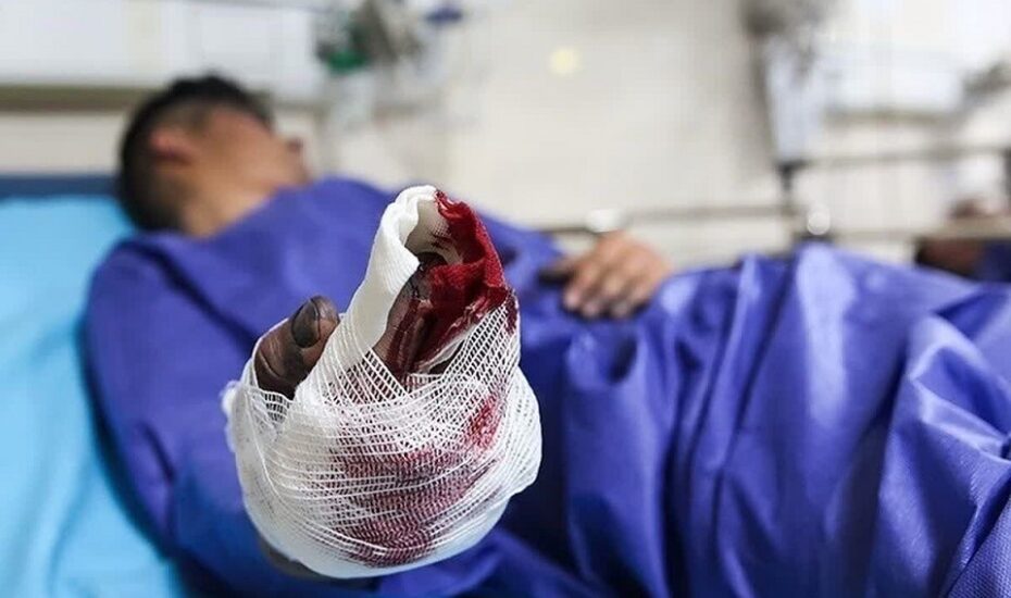 قطع انگشتان پاکبان انفجار نارنجک چهارشنبه‌سوری