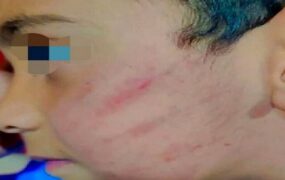 تنبیه بدنی دانش آموز دبستانی