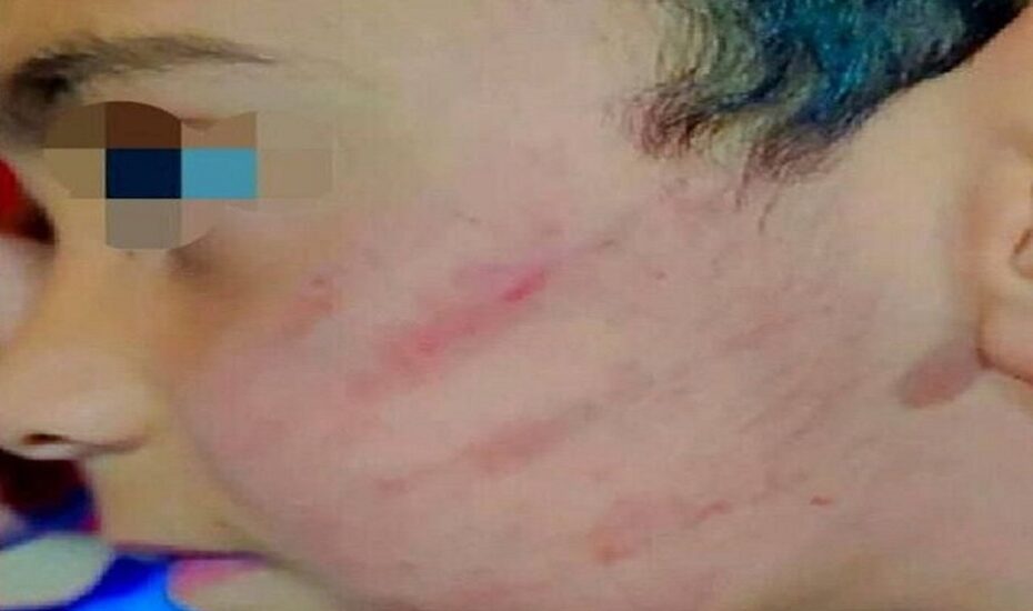 تنبیه بدنی دانش آموز دبستانی