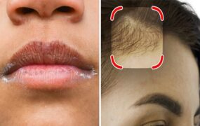نشانه های کمتر شناخته شده کمبود ویتامین D