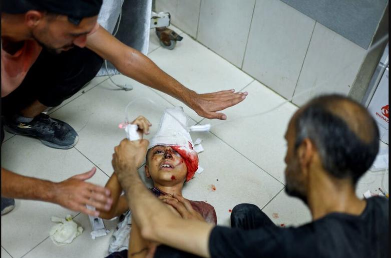 دیدنی های امروز؛ از اوضاع امنیتی پاریس تا آشتی گروه های فلسطینی کودکان مجروح شده در بمباران های اسرائیل در بیمارستان ناصر