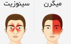 تفاوت سردرد میگرن و سینوزیت
