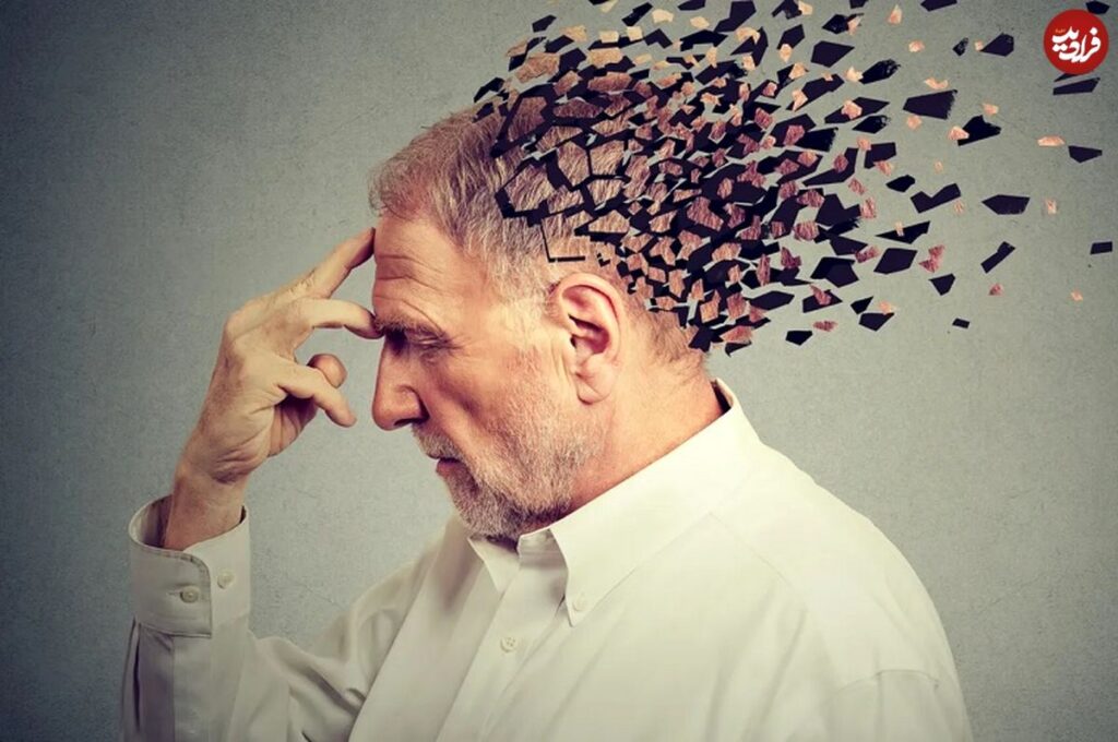 آلزایمر
