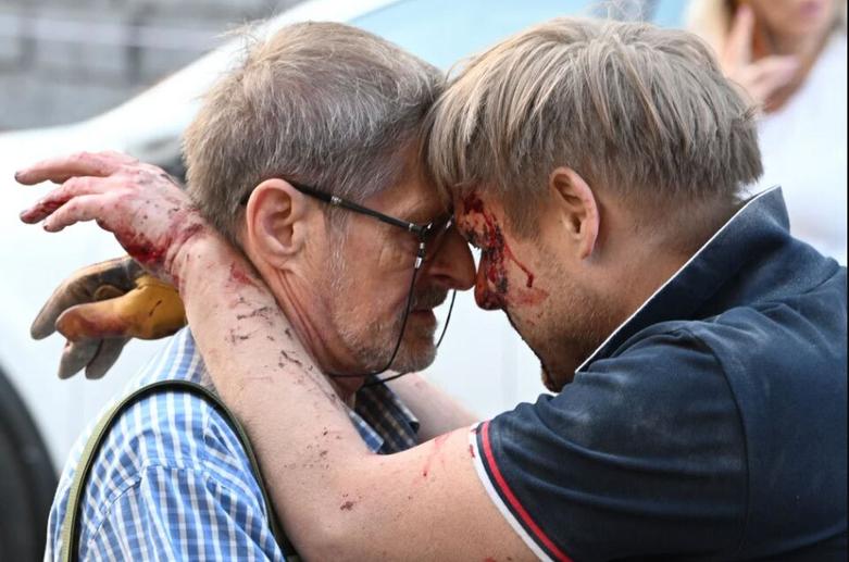 کمک به زخمی های حمله موشکی روسیه به شهر "لویو" 