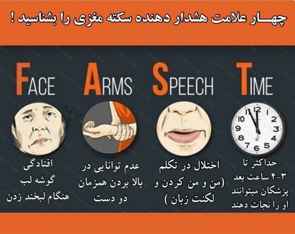 علائم هشدار دهنده سکته مغزی