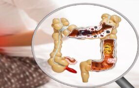 عوارض به‌موقع تخلیه نکردن روده