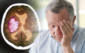 خواب آلودگی بیماری‌های مغزی