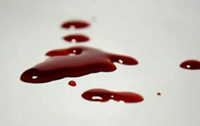قتل همسر ضربات دمبل