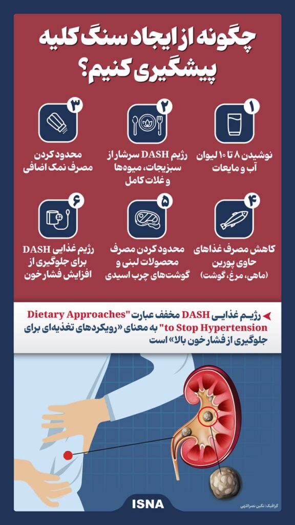 ایجاد سنگ کلیه 