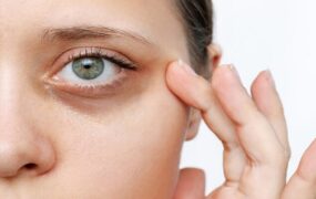 رفع تیرگی دور چشم ویتامین