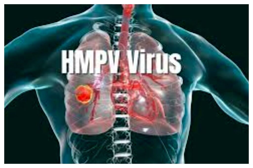 ویروس+HMPV+_