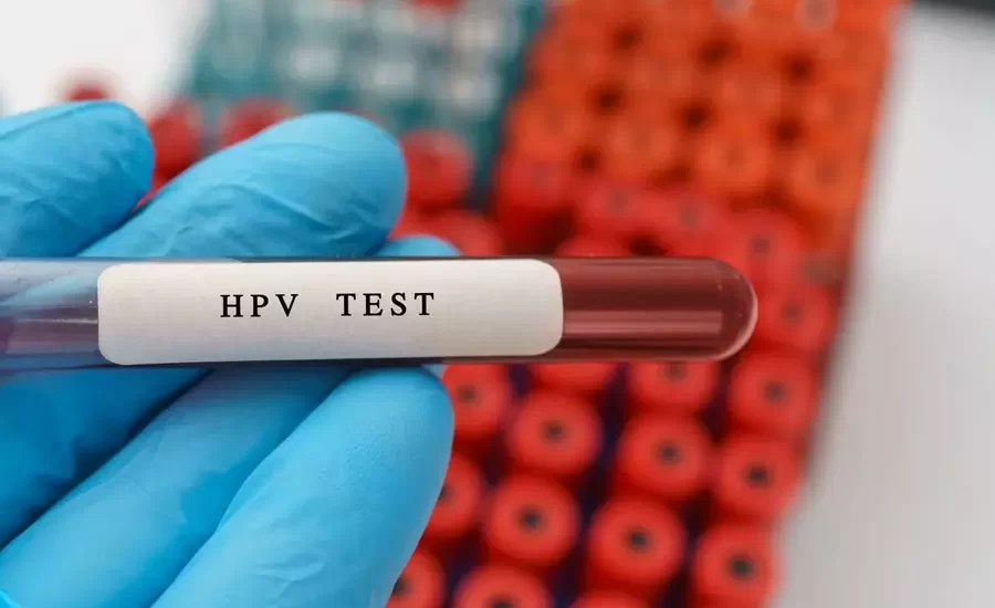 hpv