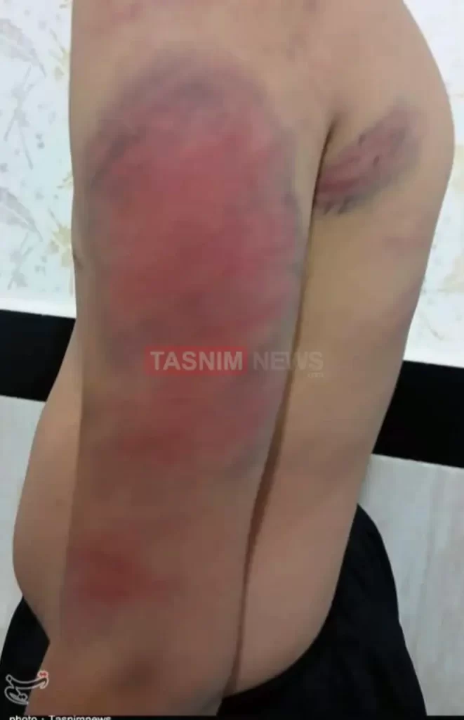 ضرب‌وشتم و شکنجه دانش‌آموزان