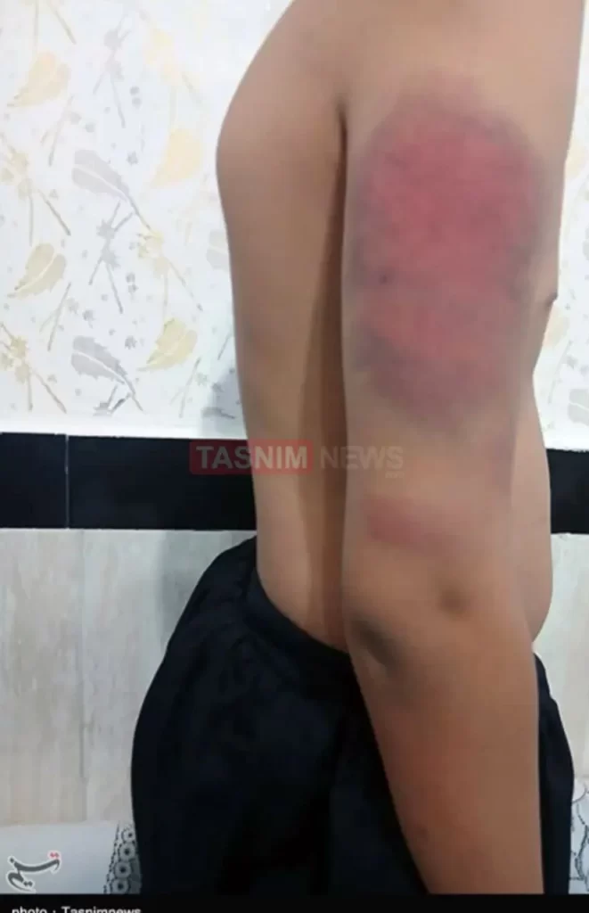 ضرب‌وشتم و شکنجه دانش‌آموزان