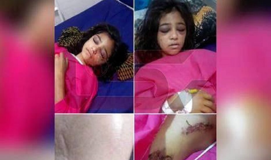 شکنجه دختر ۱۰ساله