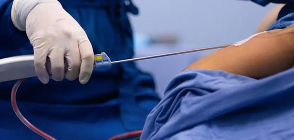 لیپوماتیک در لیماکاشت؛ سریعترین راه برای تناسب اندام