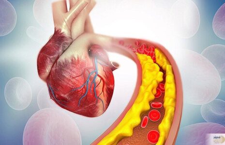 با این خوراکی ها به جنگ کلسترول بد بروید کلسترول