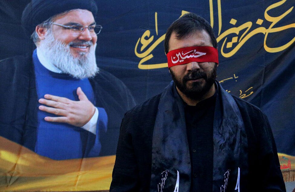جانباز انفجار پیجری سال گذشته لبنان