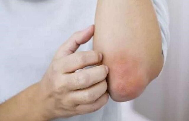 ترفندهای خانگی برای روشن‌ کردن زانو و آرنج
