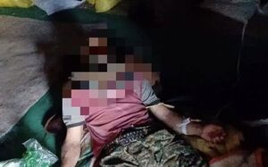 حمله خرس به نوجوان 16 ساله در بروجن خرس