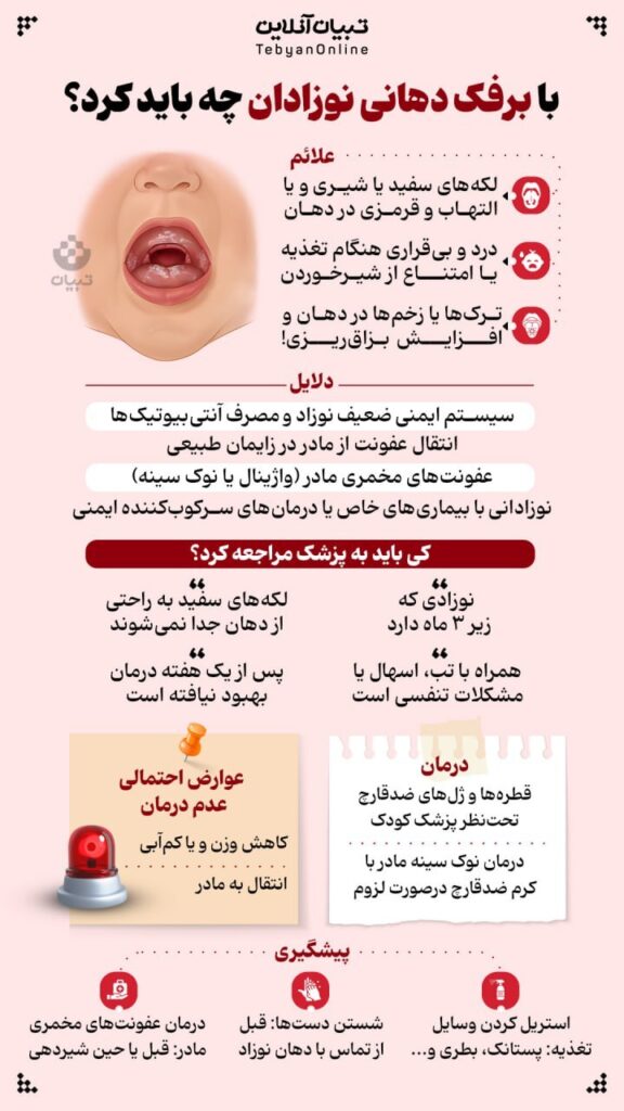 راهنمای والدین برای برفک دهانی در نوزادان/ اینفوگرافی راهنمای والدین برای برفک دهانی در نوزادان