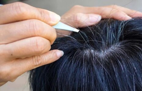 راز سفیدی مو؛ از نقش ژنتیک و استرس تا تأثیر تغذیه و طب سنتی راز سفیدی مو