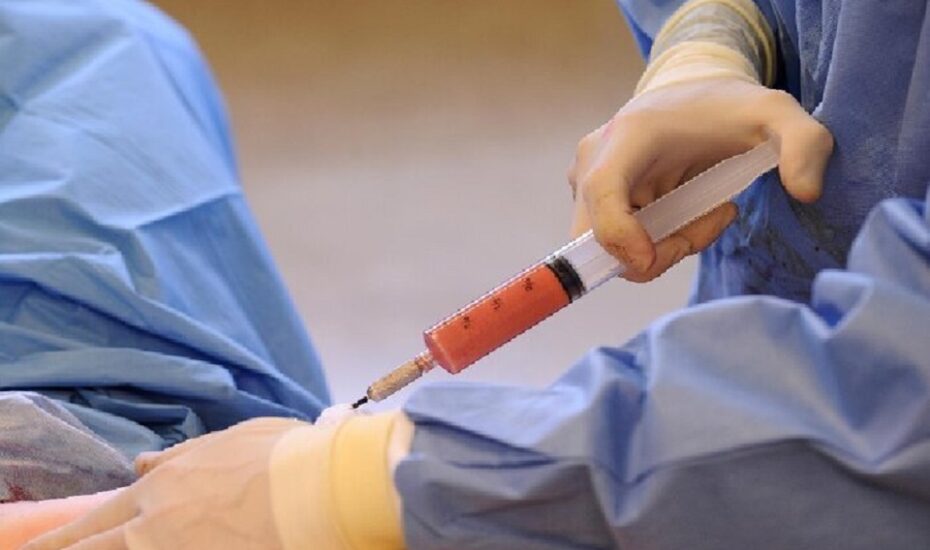 سوزاندن جسد زن جوان پس از تزریق ژل توسط پزشک زیبایی