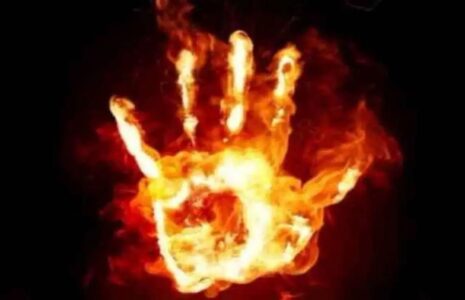 مرگ مشکوک آتش‌سوزی