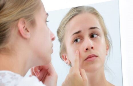 نشانه‌های اختلال بدریخت‌انگاری بدن را بشناسید