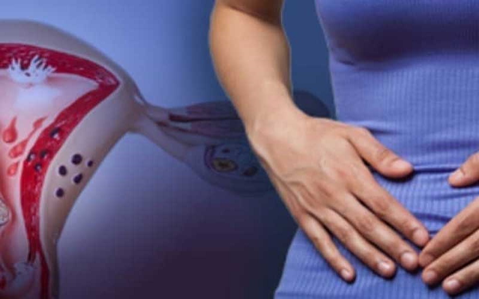 چربی شکمی؛ عامل پنهان افزایش خطر ابتلا به اندومتریوز در زنان