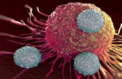 غربالگری ۳ سرطان شایع در ایران